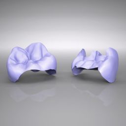 IPS e.max® CAD Inlays / Onlays, HT und LT 