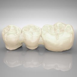 Telio® CAD Brücken und verblockte Kronen, 2 bis 16 Glieder, LT 