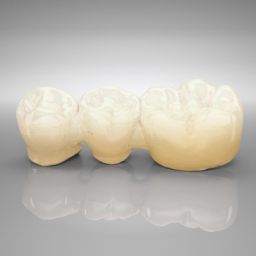 IPS e.max® ZirCAD Brücken und verblockte Kronen, 2 und 3 Glieder, MT Multi 