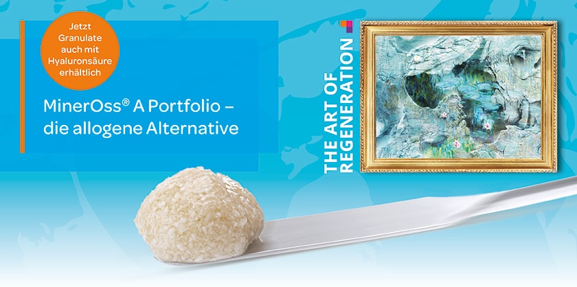 2025-09: MinerOss A + HYA